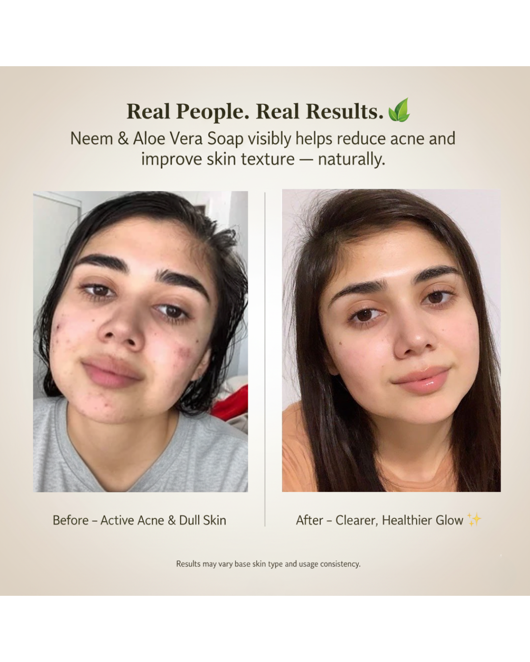 Anti-Acne Neem & Aloe Vera Soap