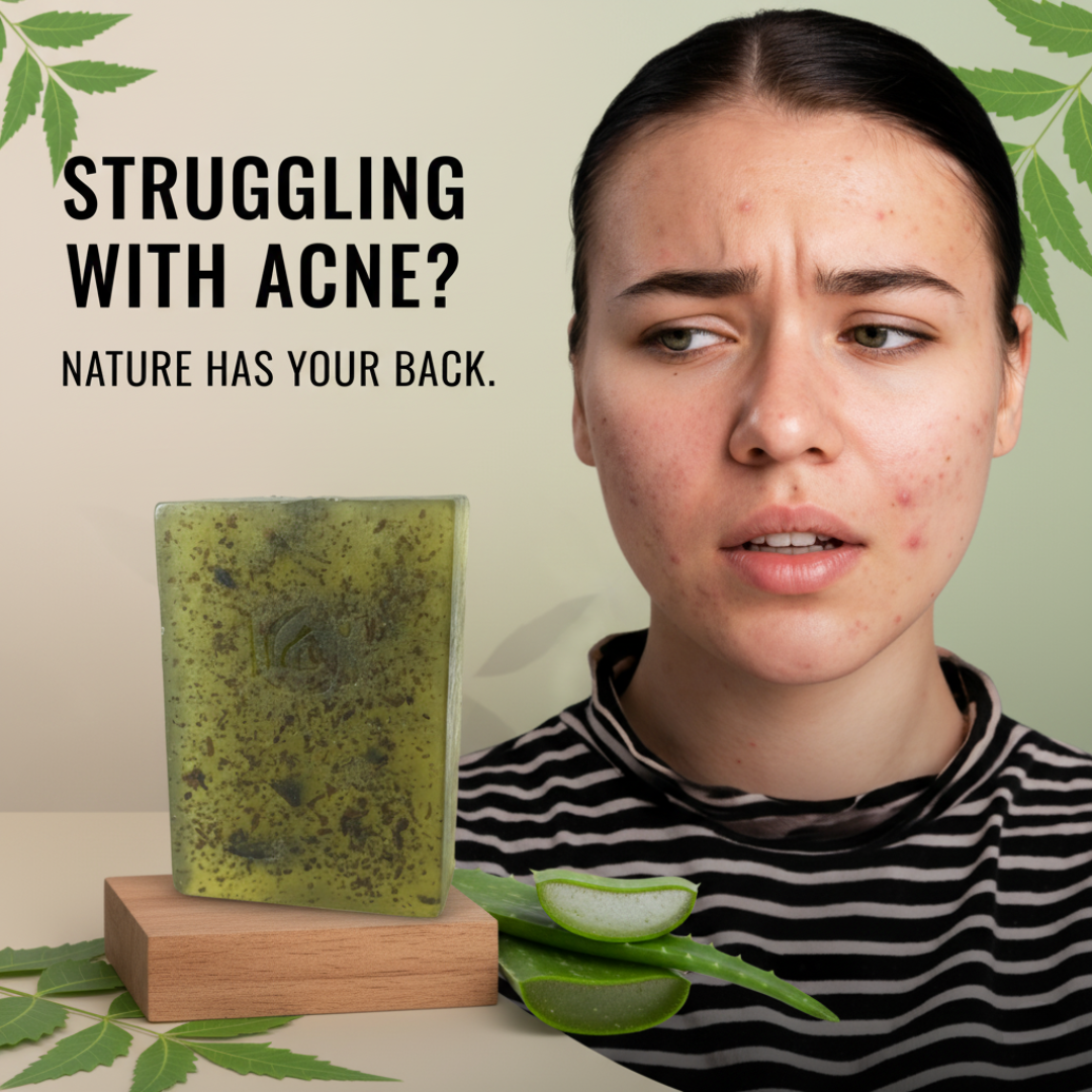 Anti-Acne Neem & Aloe Vera Soap